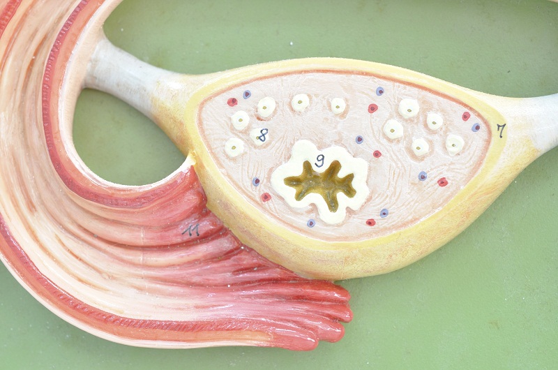 ovary.jpg