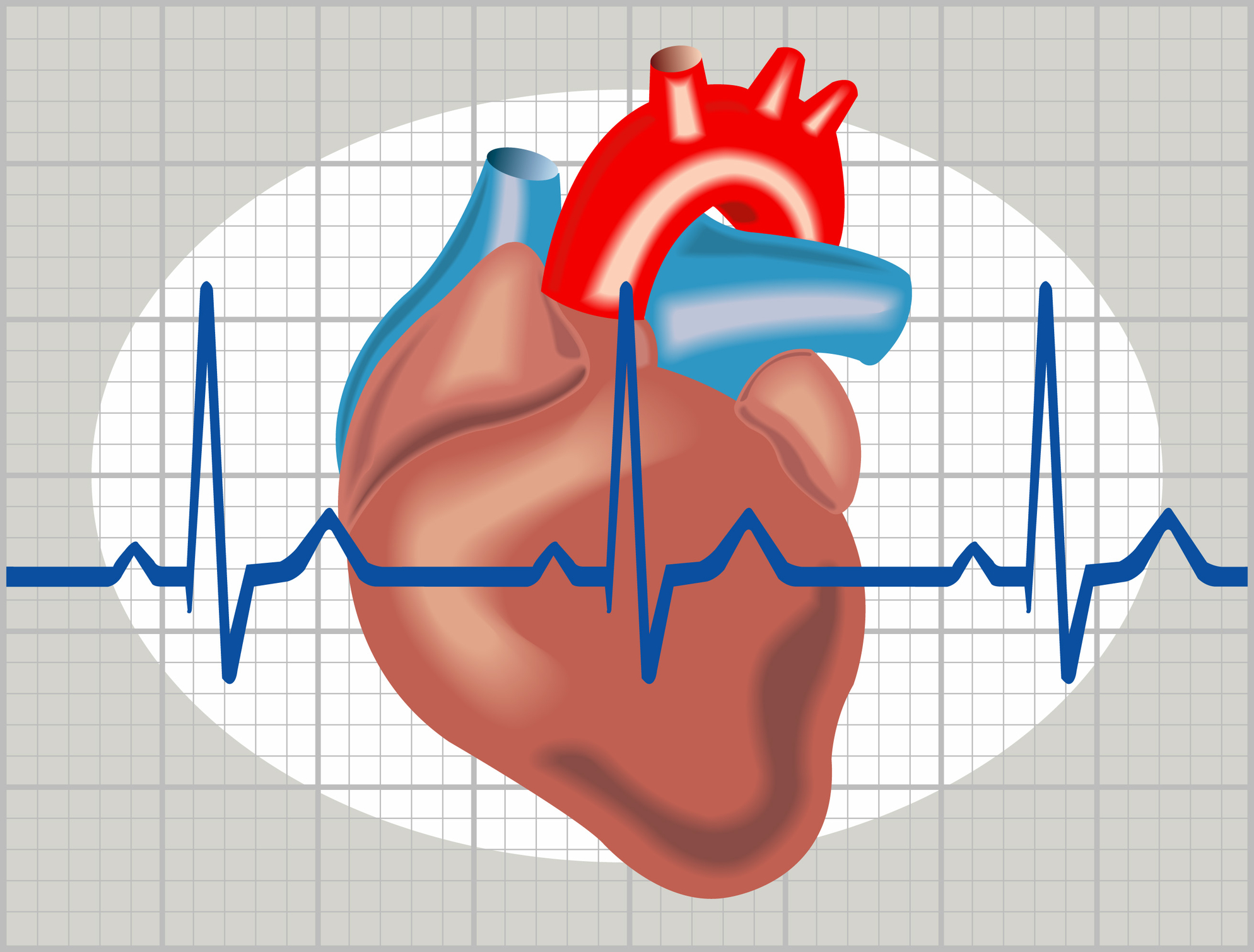 heartarrhythmia.jpg