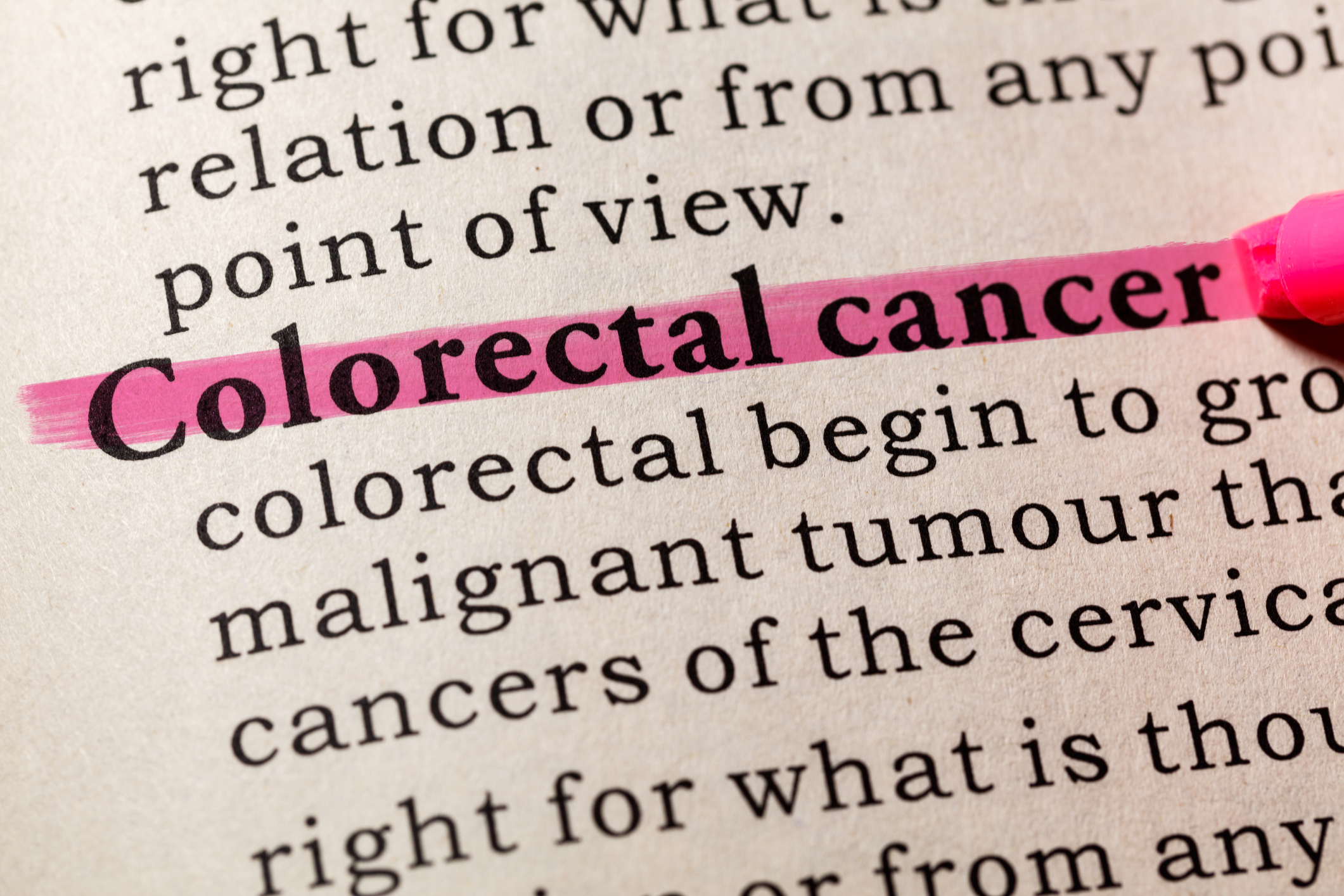 Definition-of-Colorectal-cancer.jpg