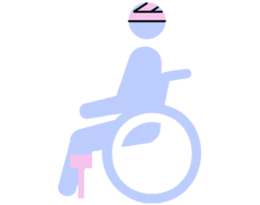 Experiencing a life-altering illness or injury